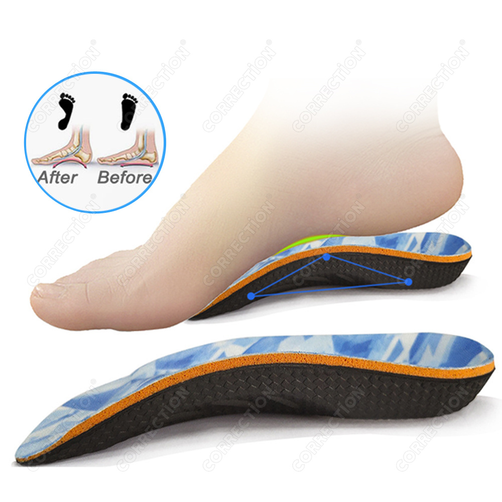 Orthopedic Insoles for Feet Sh - 3D Printing Orthopedics 评论和价格
